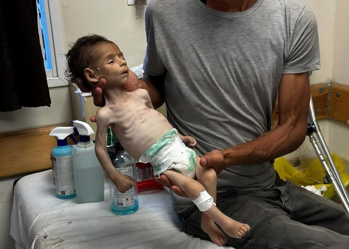 LeilaF664324's tweet image. غزة جائعة، والعالم لا يبالي. هل مات الضمير الإنساني؟
Gaza is starving, and the world is silent. Has human conscience died?
#GazaStarving
