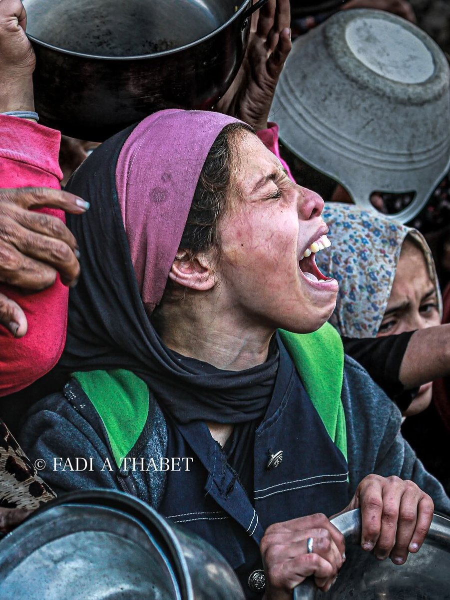 ahmd_mhna19696's tweet image. Screams of pain, a cry of pain emanating from the intestines and the heart. Please donate something to save a child and a hungry patient. Donate.
chuffed.org/project/117684…
