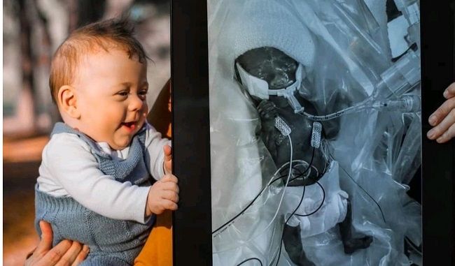 LifeNewsHQ's tweet image. Premature Baby Born at 22 Weeks is Doing Great Now buff.ly/pIisPWL