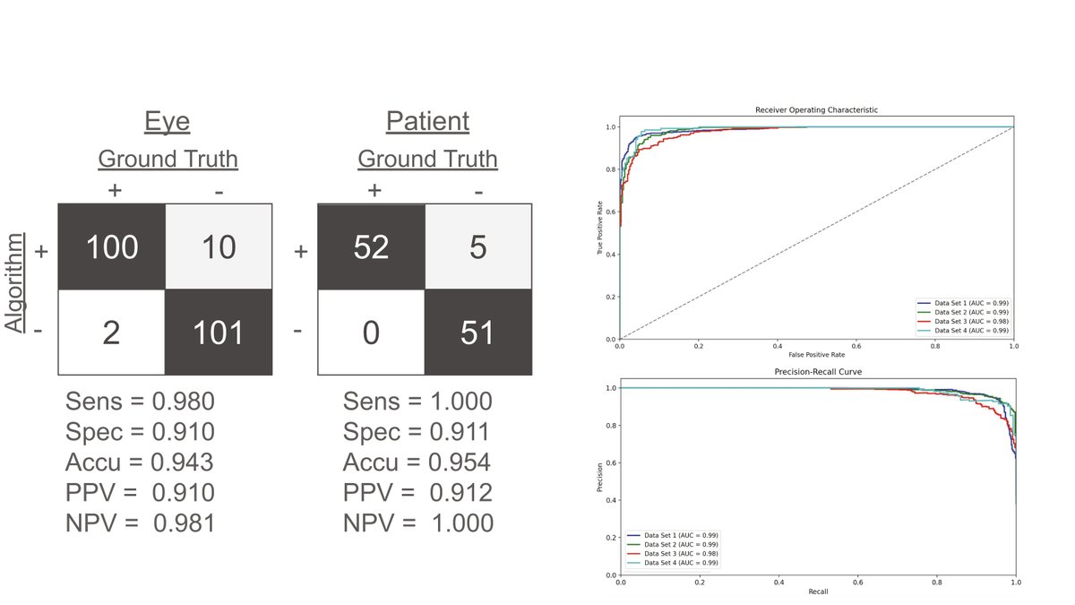 AAOjournal's tweet image. Deep-learning algorithm for the diagnosis and prediction of hydroxychloroquine retinopathy: An International, multi-institutional study
ow.ly/6q5E50Wik7f
@ptwcourt
#ophthalmology #retina