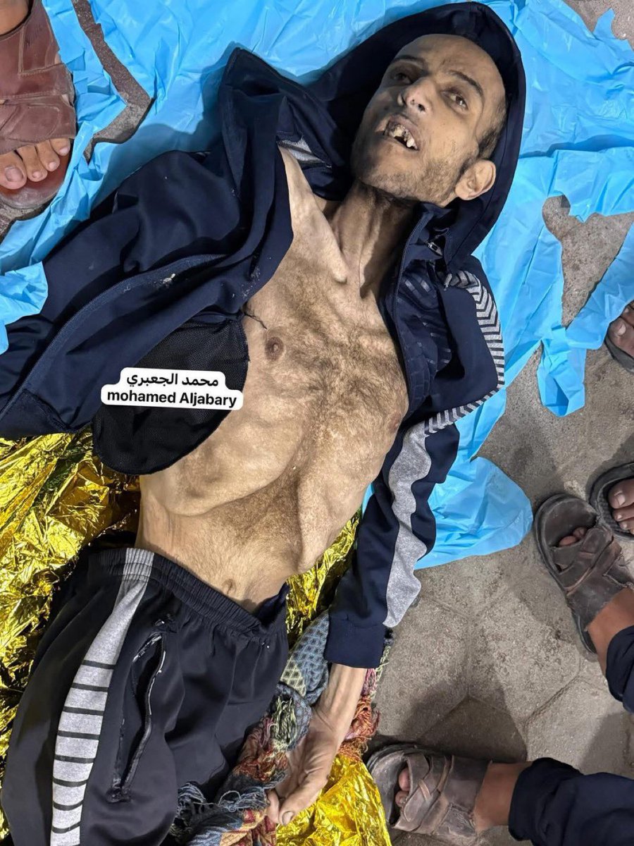 لولا القدر الكبير من النفاق الذي يصبغ القيم، ولولا وجود مكيالين في هذا العالم الأعور لتحدث الجميع عن معسكر اعتقال نازي، تغلقه إسرائيل على أكثر من مليوني فلسطيني في غز…ة، يموتون جوعاً وقتلا.

حتى اللغة لم تعد قادرة على الوصف.

#غزة_تموت_جوعا