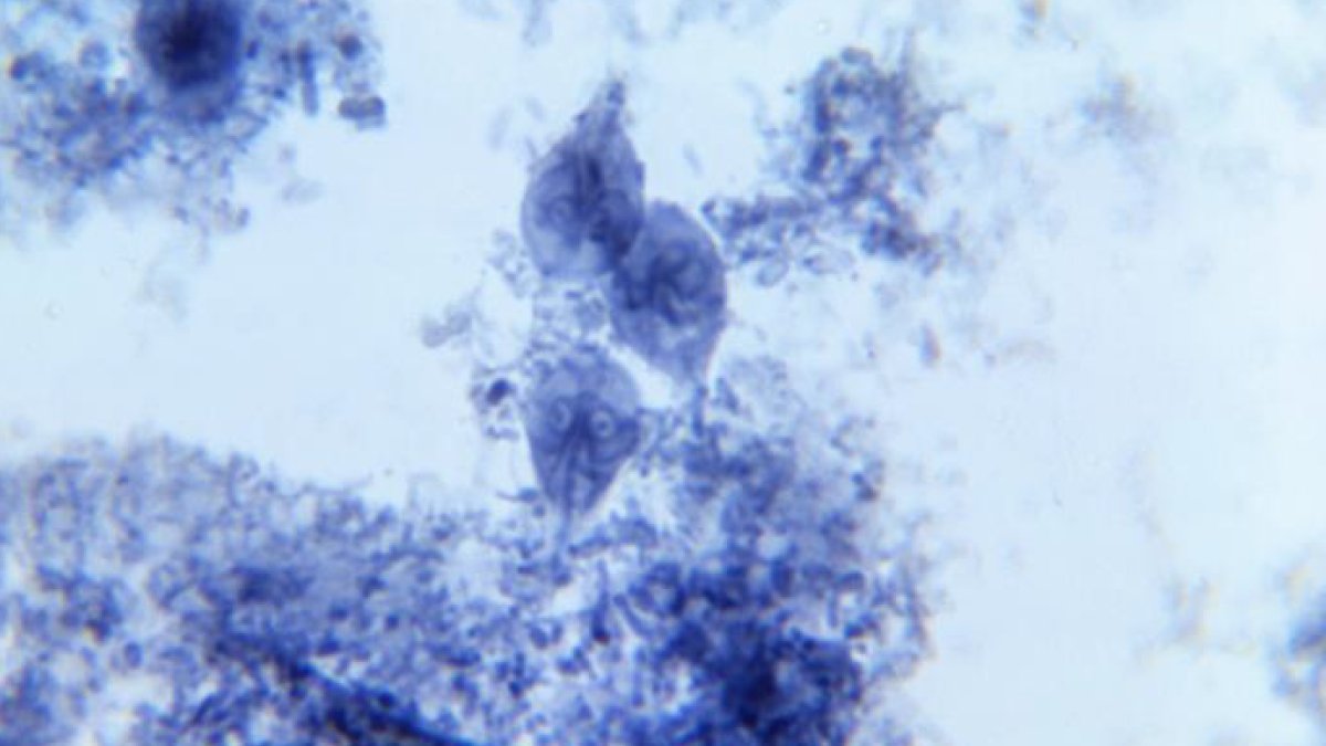 CDCMMWR's tweet image. .@CDPHE used text messages and an online survey to rapidly collect info about exposures, etc., from people with a diarrheal illness, Giardia. This approach was faster and more efficient than traditional phone interviews: bit.ly/4ePVPlj