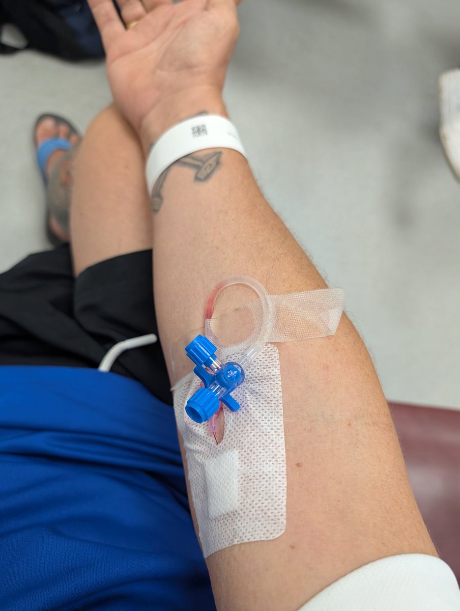 00sfield's tweet image. What a day had to phone ambulance this morning doubled up in excruciating pain CT scan revealed got kidney stone morphined up sent home with some tablets to hopefully help pass it
Not the start to week was hoping for ,,π«