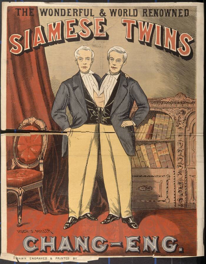 The term "Siamese twins" comes originally from #Thailand

The term "Siamese twins" was inspired by Chang and Eng Bunker, Thai brothers born in 1811, who were conjoined at the chest.