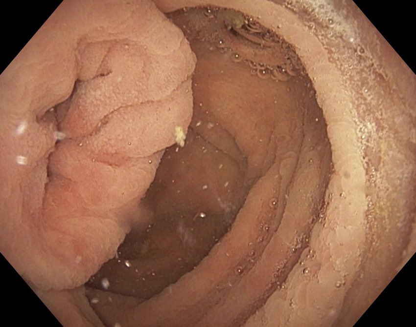 Keith Siau tweet media