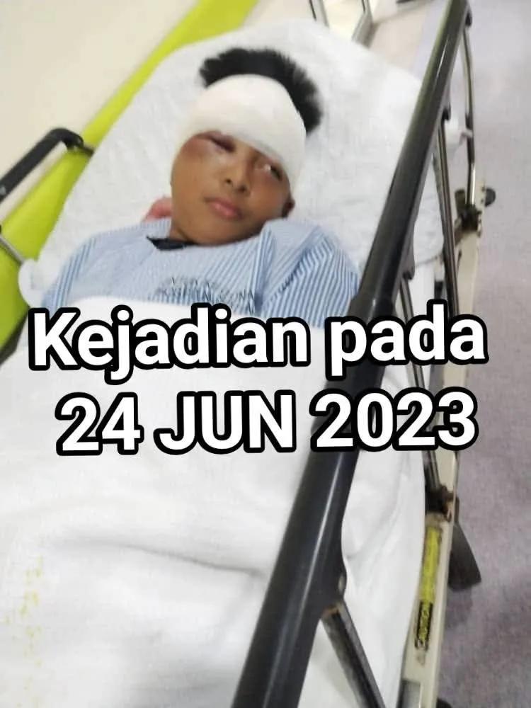mynewshub's tweet photo. SMKA Tun Datu Mustapha dah banyak kes buli berlaku sebelum ini.

Adik ni pelajar sekolah yang sama dibuli sehingga tahap ni pada 2 tahun lepas. Keluarga memang sangat marah & nak saman sekolah tetapi kewangan tidak mengizinkan. 

Bila kes kematian Adik Zara viral, mak ayah pelajar ni kesal sangat kerana tak saman sekolah masa tu.

Mungkin jika masa tu kejadian ini viral atau pihak sekolah di saman, kejadian yang menimpa adik Zara dapat dielakkan.

Sumber : FB Zakaria Bulkiah