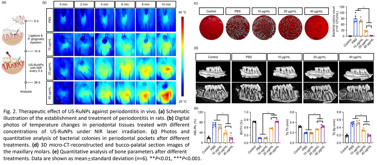 Bio-Design and Manufacturing (@biodesignmanuf) on Twitter photo Ultrasmall ruthenium nanoparticles with enhanced and tunable multienzyme-like activity for periodontitis treatment
Learn more: doi.org/10.1631/bdm.24…
<a href="/ZJU_China/">Zhejiang University</a> <a href="/sjtu1896/">Shanghai Jiao Tong University</a> Ultrasmall ruthenium nanoparticles with enhanced and tunable multienzyme-like activity for periodontitis treatment
Learn more: doi.org/10.1631/bdm.24…
<a href="/ZJU_China/">Zhejiang University</a> <a href="/sjtu1896/">Shanghai Jiao Tong University</a>