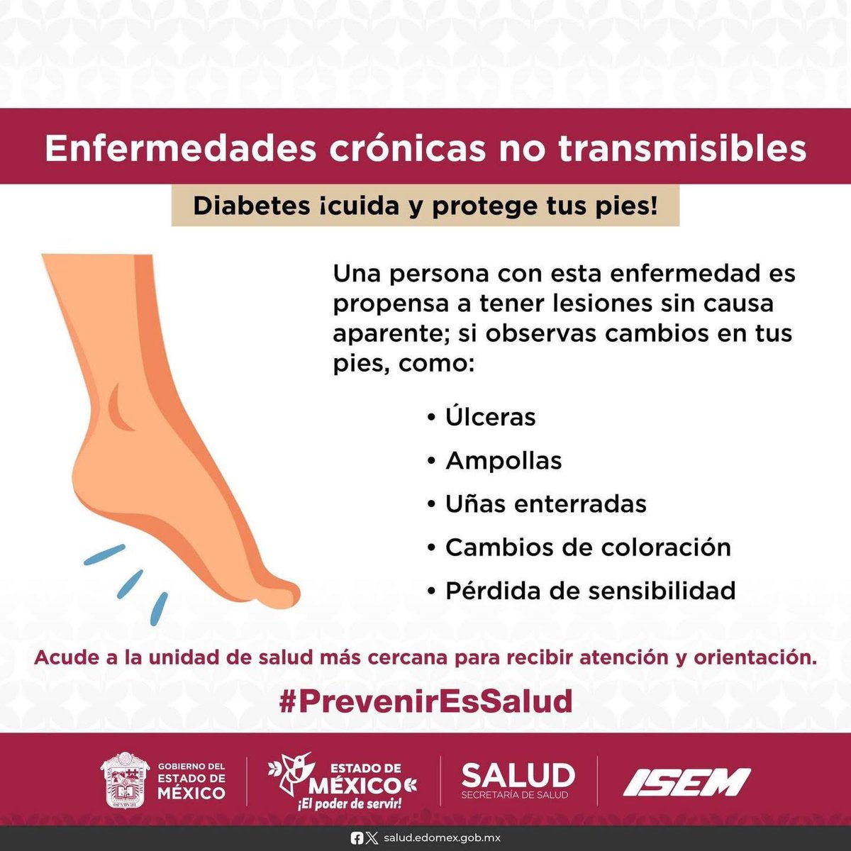 Si tienes #Diabetes, es importante poner especial atención en el cuidado de tus pies, ayudará a prevenir las úlceras del pie diabético.
#PrevenirEsSalud 
#EnfermedadesCrónicas