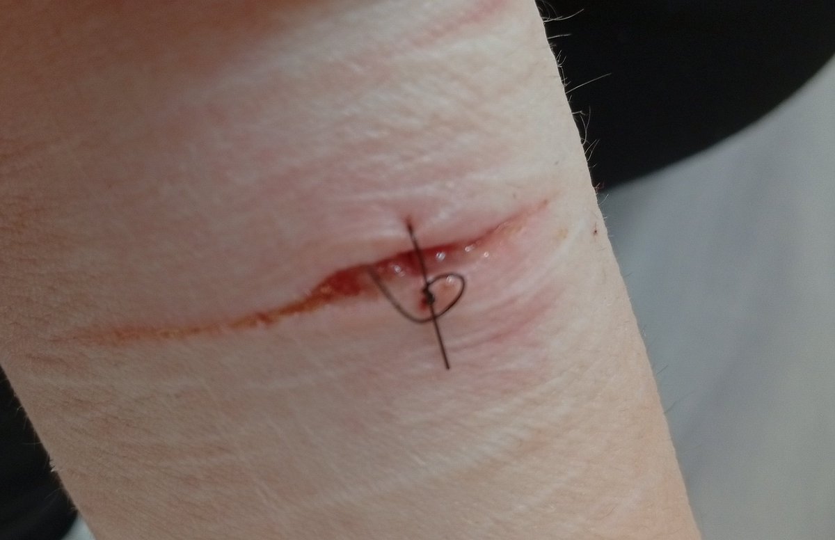 Had no scissors so I had to untie all stitches
#shtwt