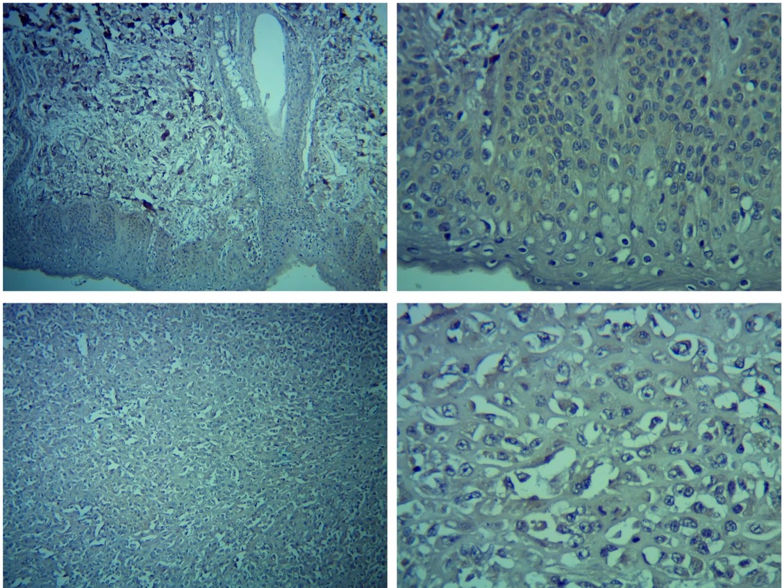 Dermal Cell News (@dermalcell) on Twitter photo Dr. Jun-jiang Chen and team reported that the depletion of TRIM3 strengthens the proliferation and mobility of #melanoma cells, and suppresses cell apoptosis, but these phenomena were counteracted by YAP1 down-regulation. | <a href="/SciReports/">Scientific Reports</a>
go.nature.com/4obRXPR Dr. Jun-jiang Chen and team reported that the depletion of TRIM3 strengthens the proliferation and mobility of #melanoma cells, and suppresses cell apoptosis, but these phenomena were counteracted by YAP1 down-regulation. | <a href="/SciReports/">Scientific Reports</a>
go.nature.com/4obRXPR