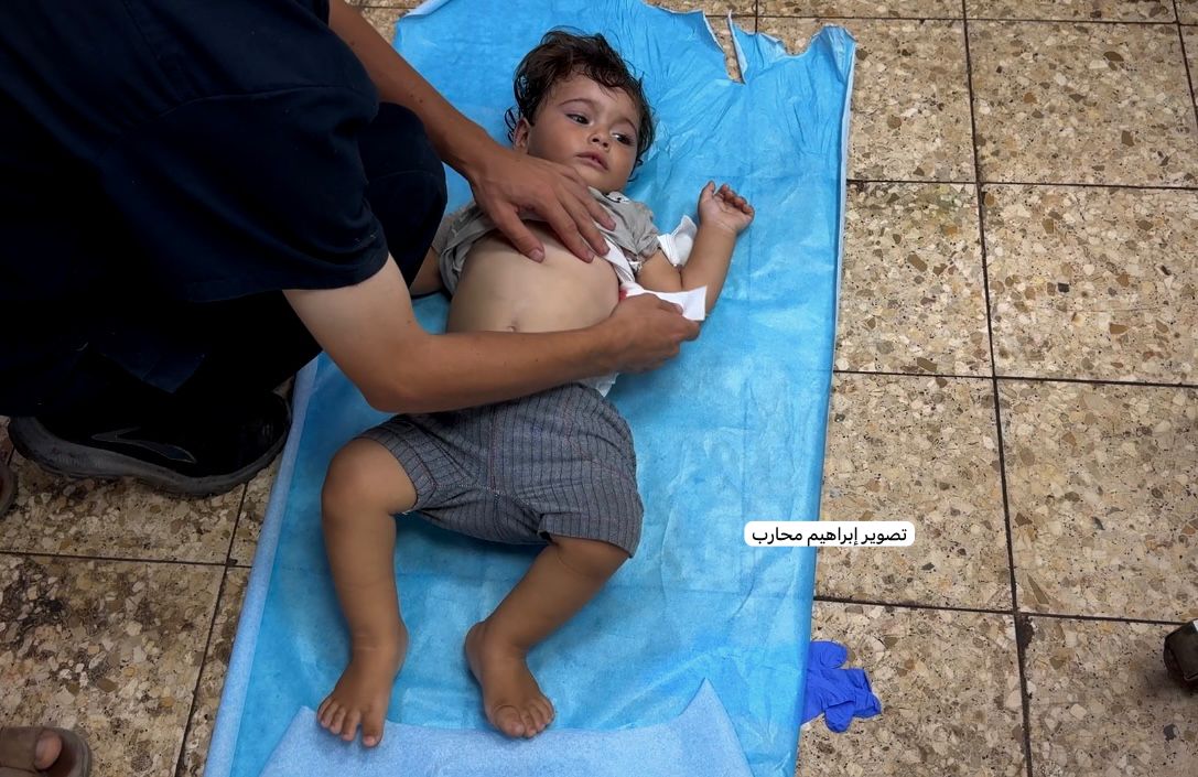 🟥 على الأرض العارية.. أرواح تُنقذ دون أسرة أو أدوات في مستشفيات غزة

#غزة_تقتل_جوعا