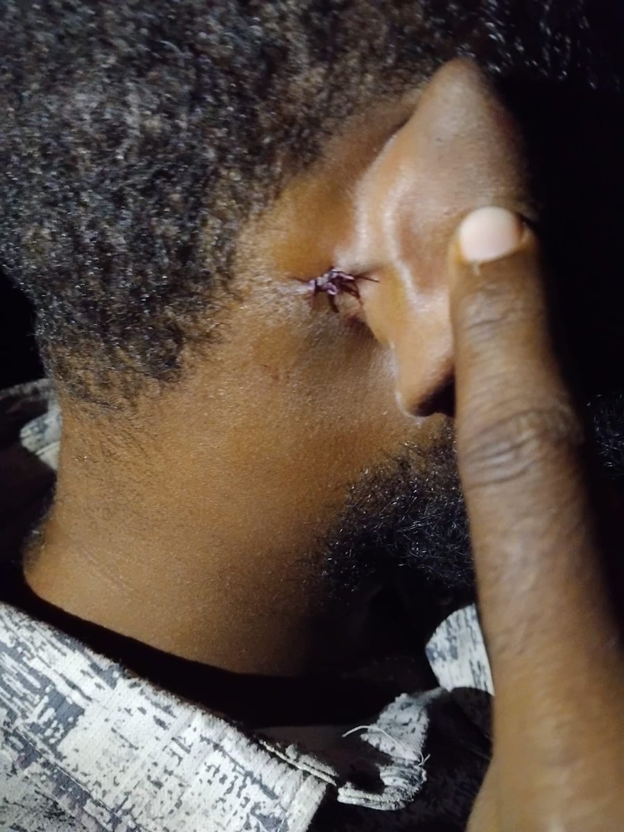 BashowAlas's tweet image. A resident of Mandera County was short on the head by a bullet from the border town of Beld Xawa this week.This regime can't even protect its own people from rogue fighting forces in the neighboring Somalia militias? We shall sue the state & demand for compensation.Unacceptable