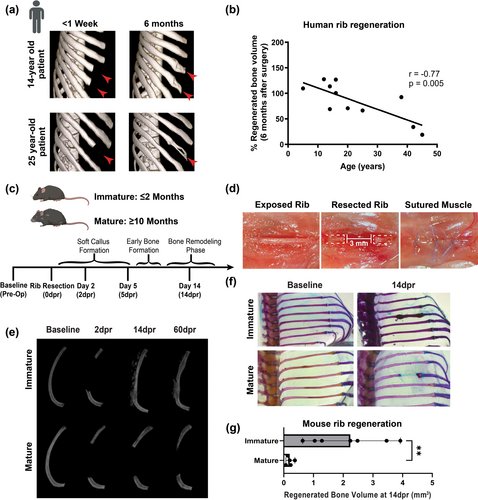 USCStemCell's tweet image. Rib regeneration declines with age, but an @Aging_Cell
study shows young blood can help. The study is a collaboration between corresponding authors Luciana Yamamoto de Almeida & Janice S. Lee from NIH, UCSF & Francesca Mariani from @USCStemCell. @marianilabusc @KECKSchool_USC