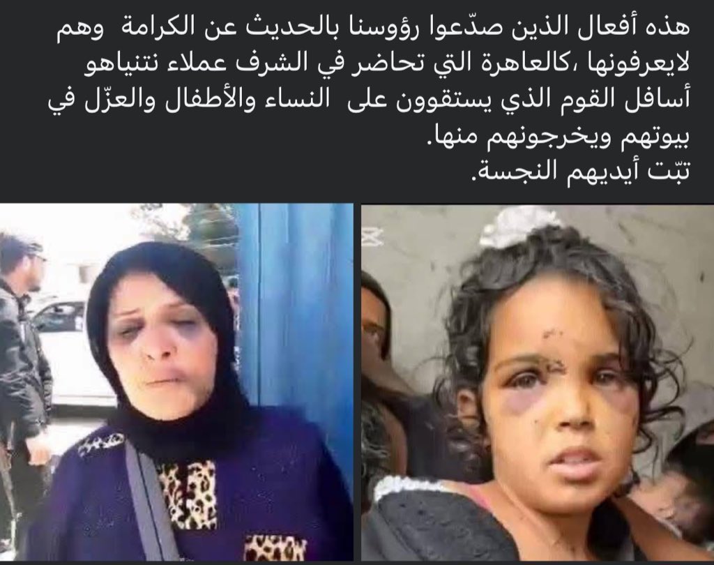 reemyousef360's tweet photo. ما جرى من سفك دماء من الطرفين كان نتيجة مباشرة لانتهاكات جماعات الهجري المدعومة من الاحتلال الصهيوني 
لا تحاولوا تزييف الوقائع فبعد قصف دمشق، شعر هؤلاء بأن الدعم الصهيوني يعزز موقفهم، وظنوا أنهم قادرون على القتل دون محاسبة
#السويداء #تهجير_قسري_للبدو_في_السويداء https://t.co/RsI54YqkaR