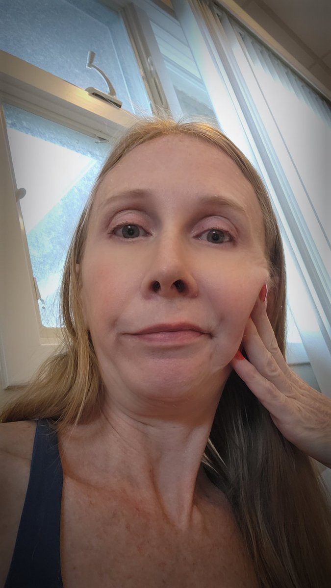 rsetera's tweet image. So, I'm at the emergency vet with Bennie. Poor guy can't catch a break. He's finally starting to walk again and now his bladder has an
obstruction.
#TeachersofX