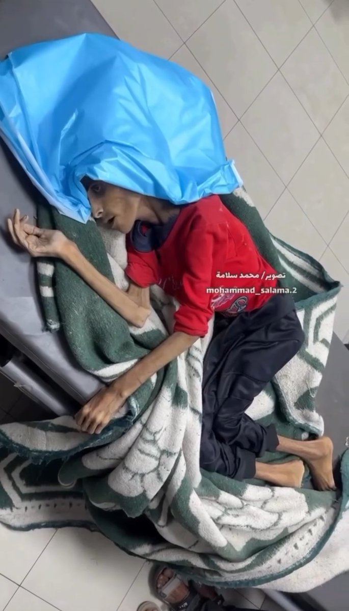 yugovaz's tweet image. Joven Palestina muerta hoy por inanición en el complejo médico Nasser en Khan Younis.
No son imagenes del pabellón femenino de Auschwitz. Son imágenes de las consecuencias del nazismo del siglo XXI.
No dejemos de hablar de Palestina.
Europa es culpable.