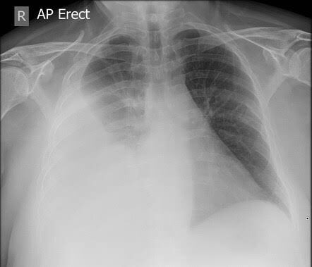 Description? Diagnosis?