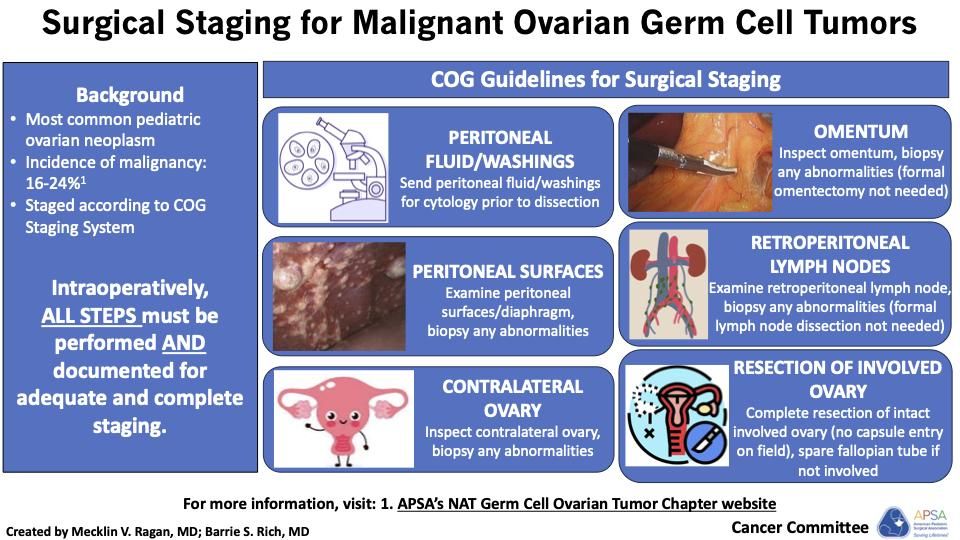 APSASurgeons's tweet image. Check out this visual abstract on surgical staging for malignant ovarian germ cell tumors. #APSALearning