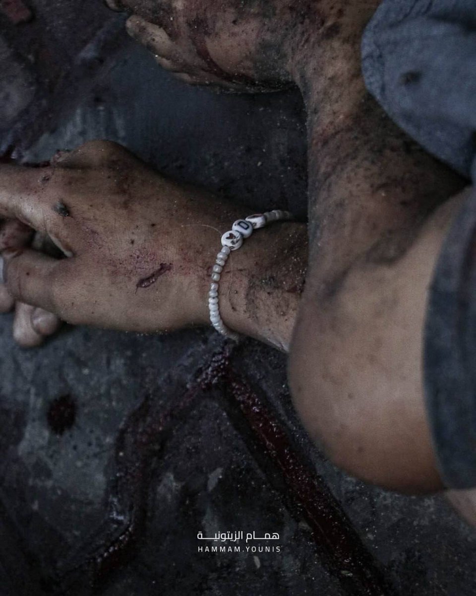 ME_Observer_'s tweet image. ⚡️ Holding her brother and her bracelet in her hand... A child was martyred alongside her little brother in an occupation bombing on Gaza City.