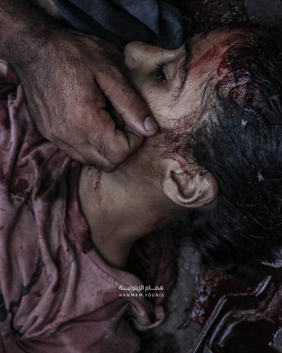 ME_Observer_'s tweet image. ⚡️ Holding her brother and her bracelet in her hand... A child was martyred alongside her little brother in an occupation bombing on Gaza City.