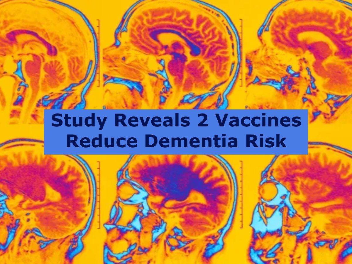 Immunize_USA's tweet image. A new study suggests that the shingles vaccine and the RSV vaccine may be associated with a reduced risk of dementia.
yahoo.com/news/huge-stud…
#immunizations #vaccine #publichealth #dementia #rsv #shingles
Donate
immunizeusa.salsalabs.org/donatetotip202…