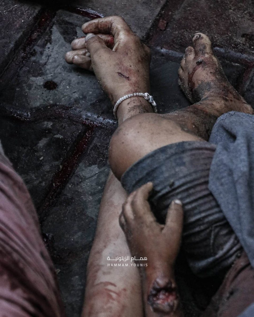 gazanotice's tweet image. ⚠️Sensitive Content ⚠️
🚨BREAKING: She held her little brother tightly, her bracelet still around her wrist,
Both were killed in an Israeli airstrike on Gaza City.
Another childhood erased in a moment.