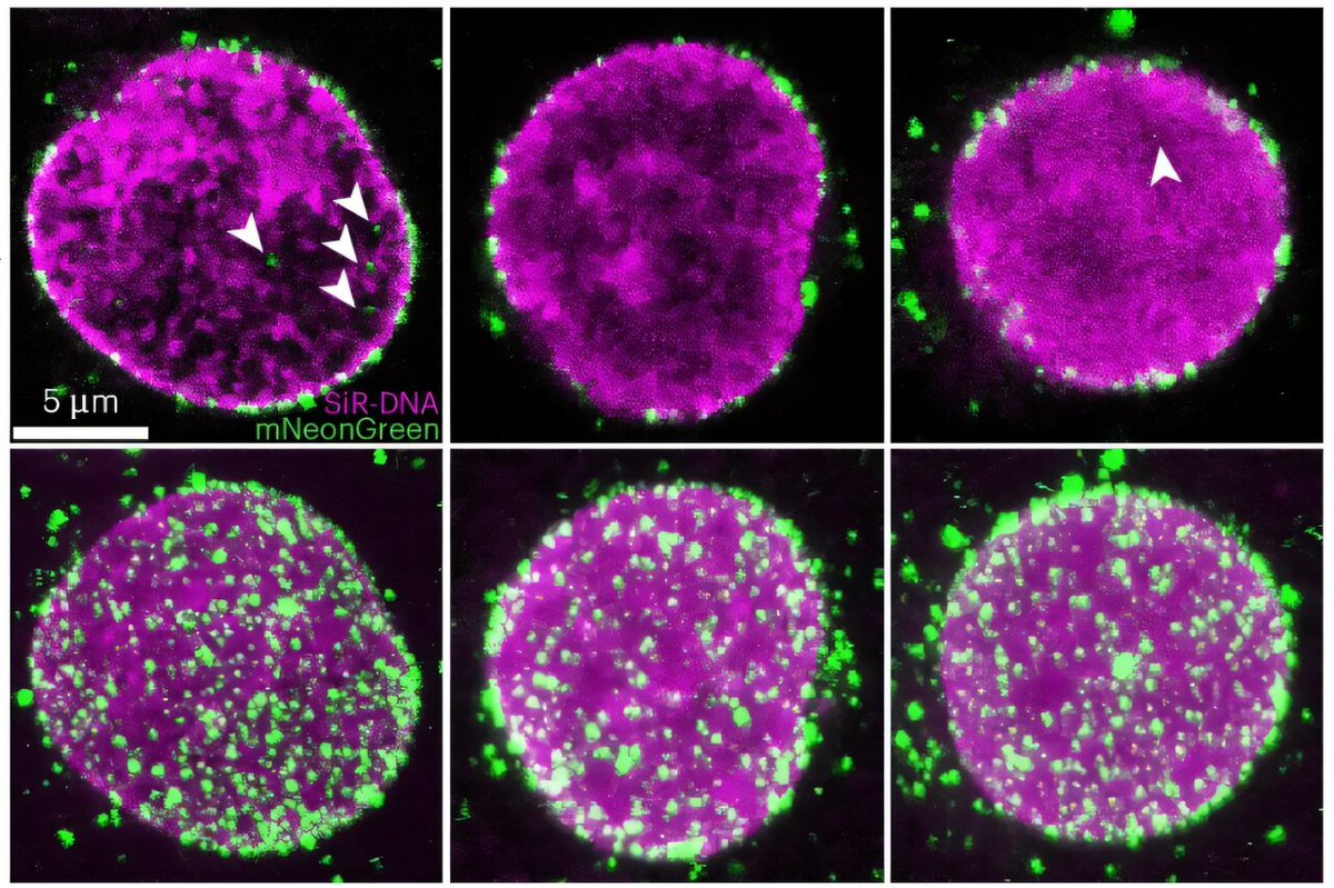 Scientists capture HIV-1 viral cores entering the nucleus in unprecedented detail