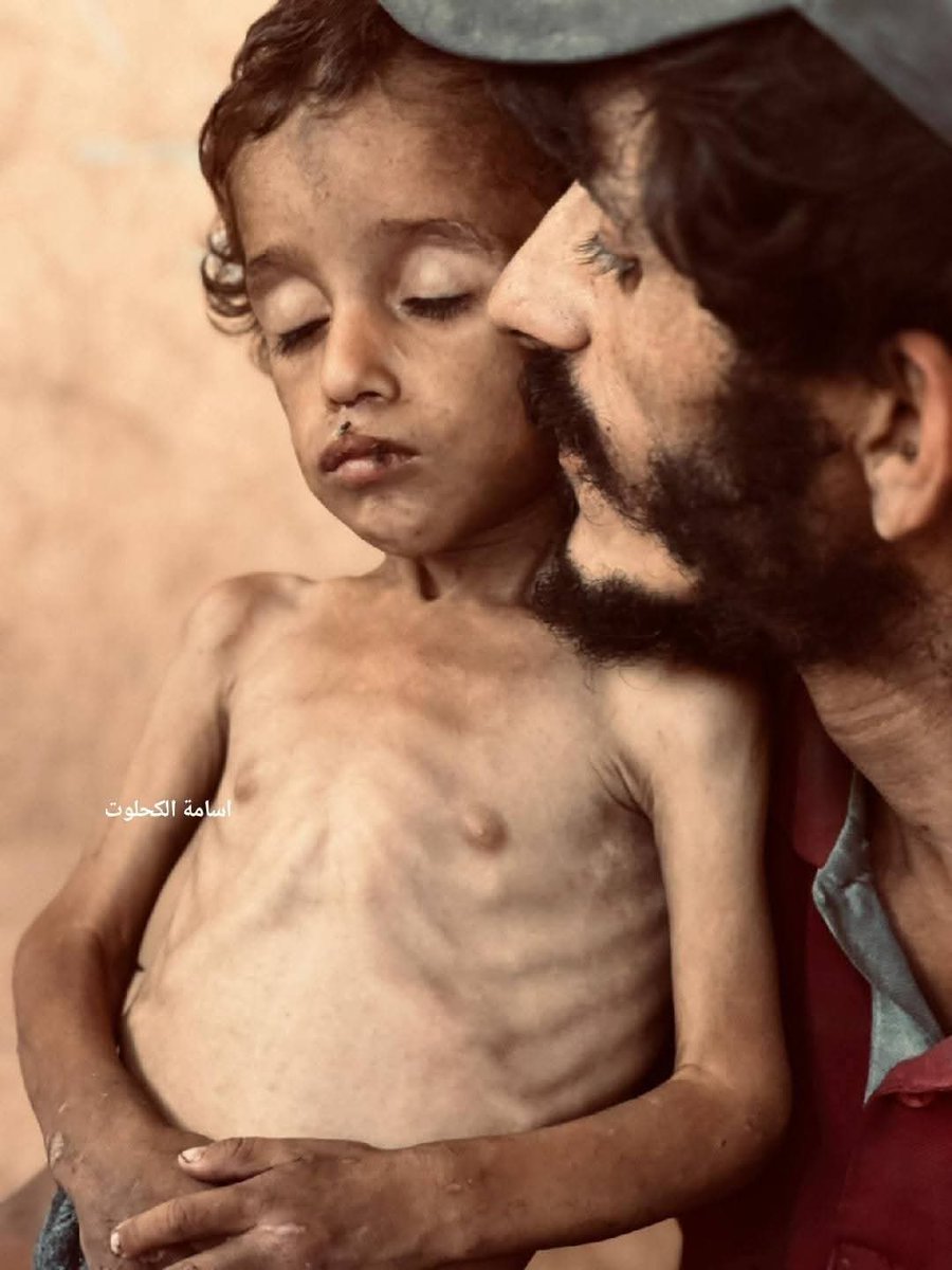 وعند الله تلتقي الخصوم ، لن نسامحكم ..
لقد رأيتمونا صوتاً وصورة وشاهدتم مجاعتنا على مرأى عيونكم وعلى مسامع آذانكم ..
لقد بُلغتم عن وجعنا وجوعنا ، ولم تتحرك قلوبكم ، ولا ضمائركم، أنتم خصمنا أمام الله يوم القيامة 💔
غزة تموت جوعاً ..