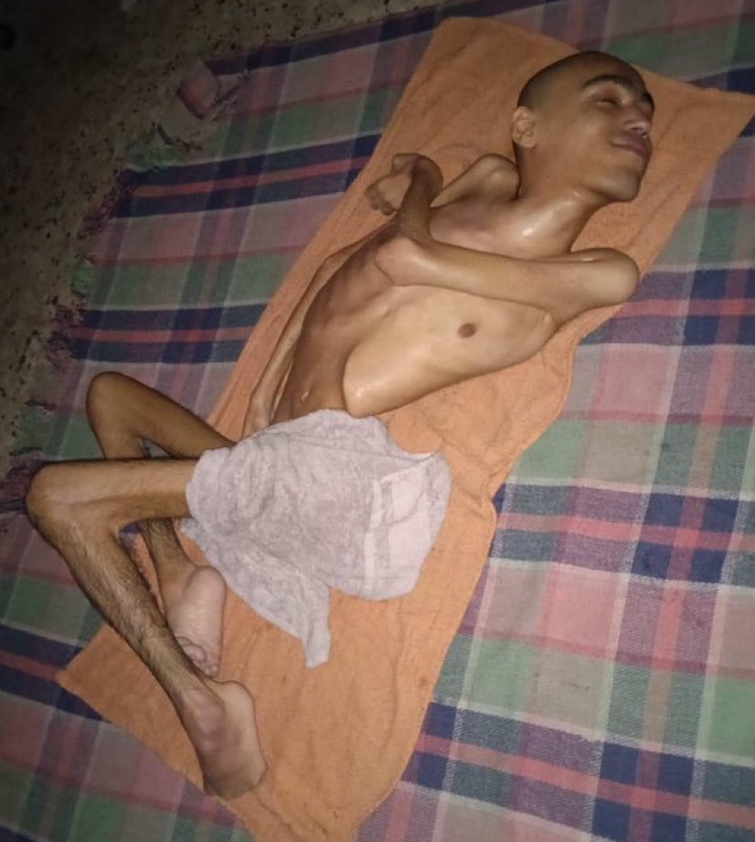 أعلم بأن الصورة صادمة

ولكن حتى يدرك الجميع خطورة الوضع، نحن في كارثة تاريخيّة 

مدينة كاملة على حافة الموت تجويعاً.