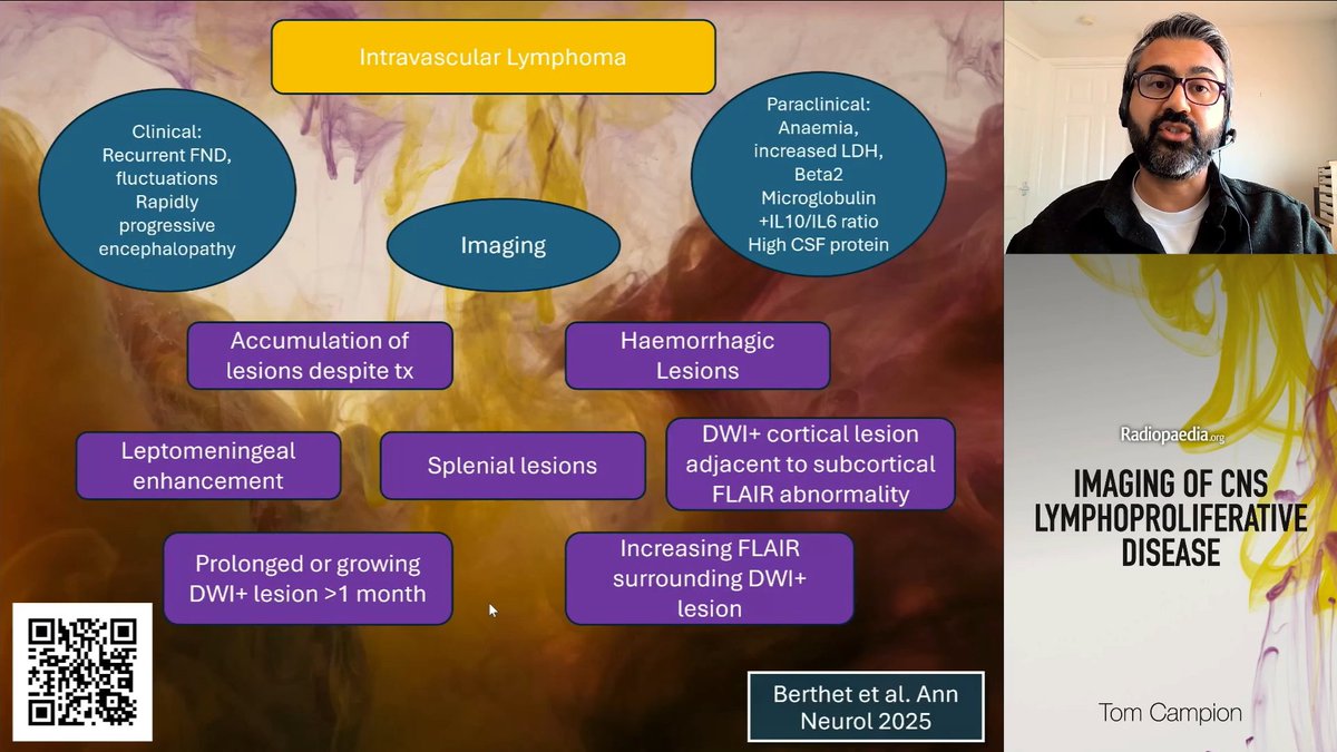 Rohit Sharma (@piandro3142) on Twitter photo Helpful pearls from <a href="/tmcampion/">Tom Campion</a> on my catch-up of Day 1 #Radiopaedia2025 regarding suspicious imaging features of intravascular lymphoma. A diagnosis we think about a lot, but diagnose very little of! Helpful pearls from <a href="/tmcampion/">Tom Campion</a> on my catch-up of Day 1 #Radiopaedia2025 regarding suspicious imaging features of intravascular lymphoma. A diagnosis we think about a lot, but diagnose very little of!