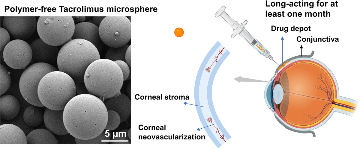 JCRnEDITORS's tweet image. Polymer-free tacrolimus microsphere implants for long-acting prevention of corneal neovascularization in rats by subconjunctival injection.
| Dengning Xia @sysu_1924 |
[50 days&apos; free access]
#OcularDelivery #microsphere #implant 
kwnsfk27.r.eu-west-1.awstrack.me/L0/https:%2F%2…
