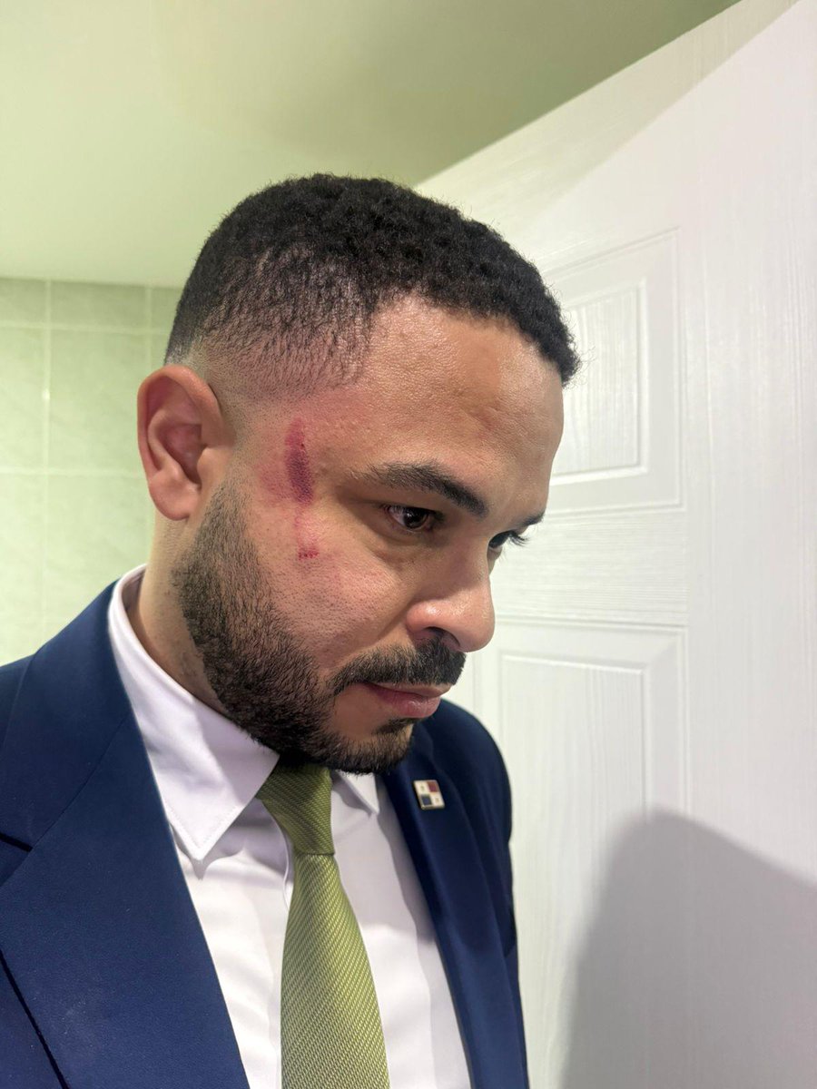 🚨#LoÚltimo El diputado Betserai Richards fue agredido por el diputado del PRD, Jairo Salazar. Me amenazó y me dijo "tu vida puede correr peligro... voy a luchar hasta acabarlos" denunció Richards.