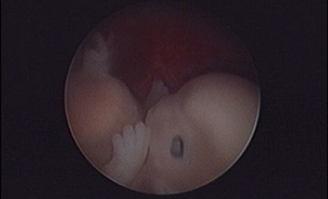 LifeNewsHQ's tweet image. Embryoscopy: Powerful Technology That Proves Unborn Babies are Human Beings buff.ly/hXNMlW4