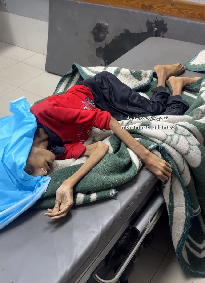 MosabAbuToha's tweet image. Rahel Rasras, 32 years old, died of malnutrition today.