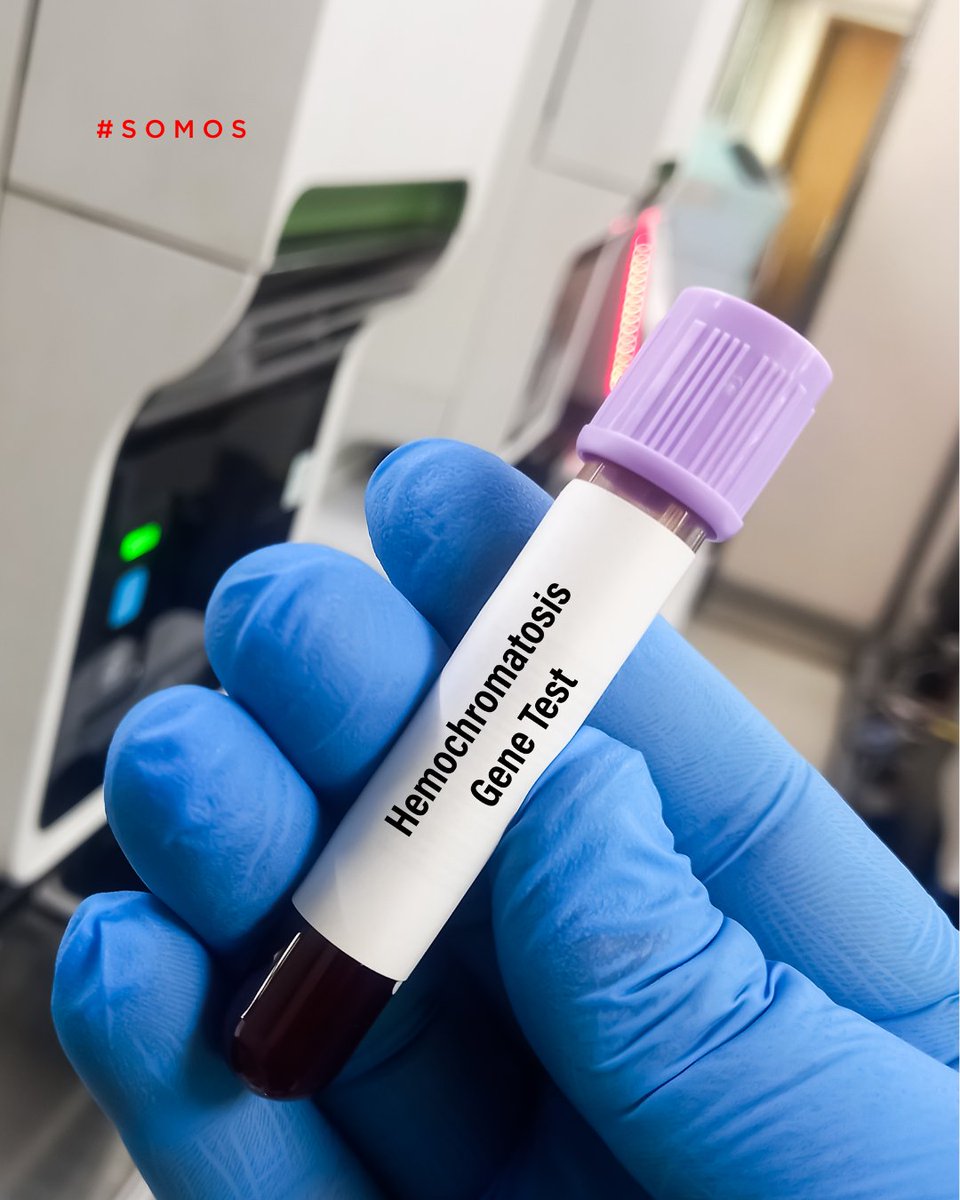 Hemochromatosis is a condition where your body absorbs too much iron from the food you eat. That extra iron gets stored in your organs silently causing damage to them over time.

The good news is that it can be detected with a simple blood test and it can be treated.

#somoscare