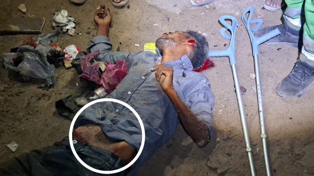 AnasAlSharif0's tweet image. A emaciated body, crutches by his side, and blood covering his head... This man was martyred, starving and injured, in an Israeli bombardment targeting the tents of displaced people in the Shati refugee camp, west of Gaza.
جسد هزيل، عكازان بجانبه، ودماء تغطي رأسه... هذا الرجل…