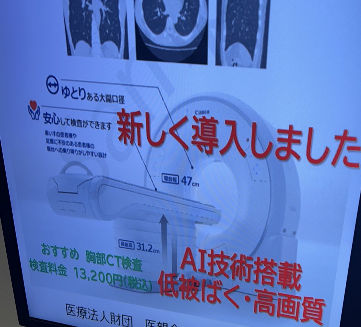 AI技術搭載！

低被ばく・高画質！！

最強無敵ベネフィット直撃無双ライティングなのでオプション課金します♨️