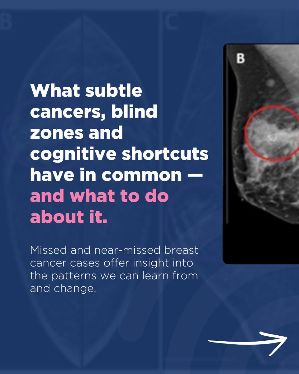 BreastImaging's tweet image. This case-based review explores how these factors appear in real-world scenarios and offers practical strategies to improve accuracy.
Read the full article: oup.pulse.ly/eiok8cauxw #BreastImaging #BreastHealth #Mammogram #RADs