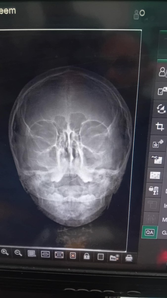 hind_naeem12's tweet image. I don't know what to do when we were evacuated from the house. We left my father's medications out of fear. My father fainted. His health is deteriorating. I'm worried. My father has a stroke. We need $300 to buy the medication. Help my father.๐ญ๐ญ๐ญ๐