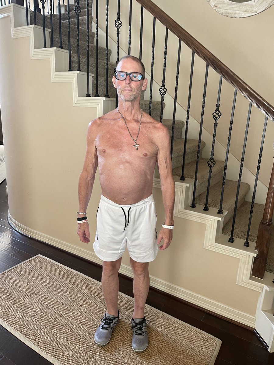 KurticusHester's tweet image. This is what cancer will do to 190lb body down to 143lbs. But I am on my way back up to 150lbs today. Hard to put on weight with a vegetarian diet!
#Unbreakable