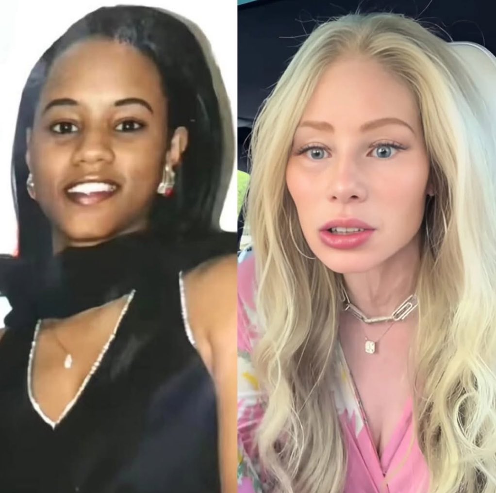 truthtroll_X's tweet image. Same person lol
Donna Briggs, is a US black woman who has “changed race” using surgery and skin treatments.
Do you think she will tell the father if she gets pregnant? Or just wait and surprise him?🤣