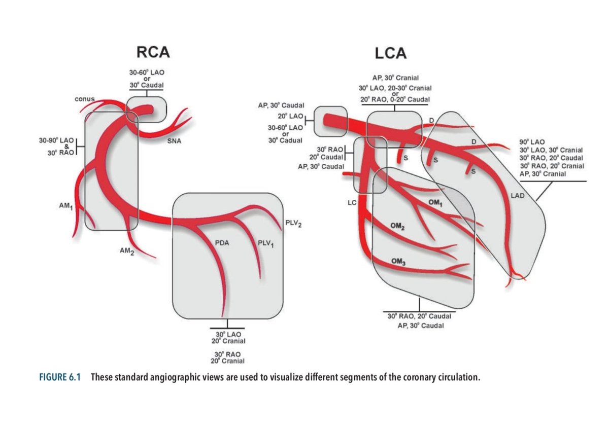 Standard angiographic views are used to visualize different segments of the coronary circulation