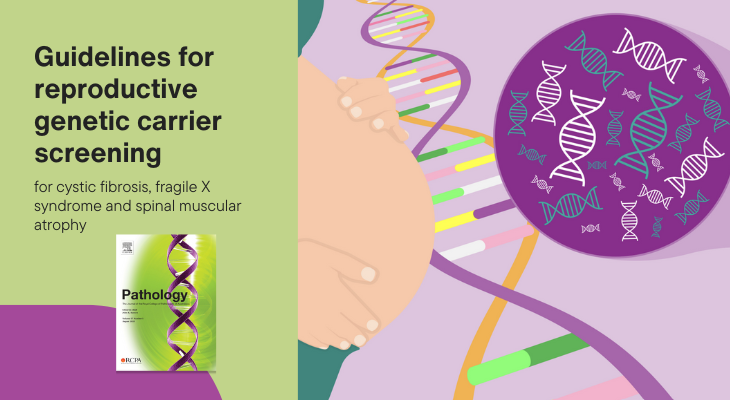 Pathology Journal (@pathology_rcpa) on Twitter photo ➡️ rcpa.me/PathJournalAug…
Developed by @pathologyrcpa and <a href="/HGSAAustralasia/">Human Genetics Society of Australasia</a>, these guidelines for the implementation of three-condition reproductive genetic carrier screening are designed to provide equitable, high-quality testing. Read now in the August issue. ➡️ rcpa.me/PathJournalAug…
Developed by @pathologyrcpa and <a href="/HGSAAustralasia/">Human Genetics Society of Australasia</a>, these guidelines for the implementation of three-condition reproductive genetic carrier screening are designed to provide equitable, high-quality testing. Read now in the August issue.