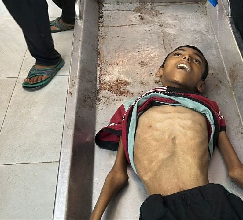 ahmd_mhna19696's tweet image. For the last 14 years, we have been dying one after the other, and everyone is watching without mercy or help.
chuffed.org/project/117684…