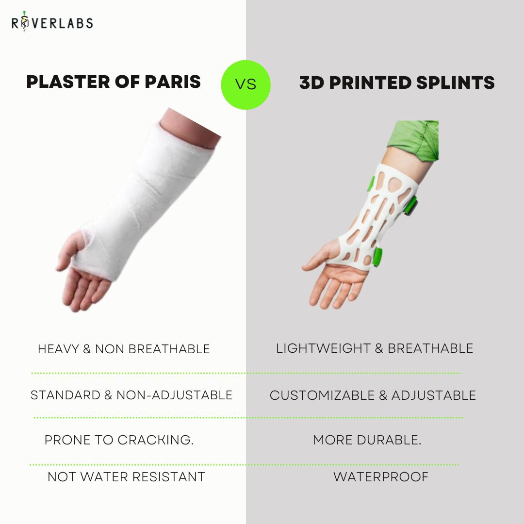 RoverlabsTz's tweet photo. POP casts align injuries well, but 3D-printed splints do it smarter: waterproof (easy showers), lightweight, breathable, and adjustable for comfort as you heal. No more heavy, soggy casts. 

Heal cleaner, live lighter. 

#3DPrinting #OrthoCare #InjuryRecovery https://t.co/GMXqznVyKu