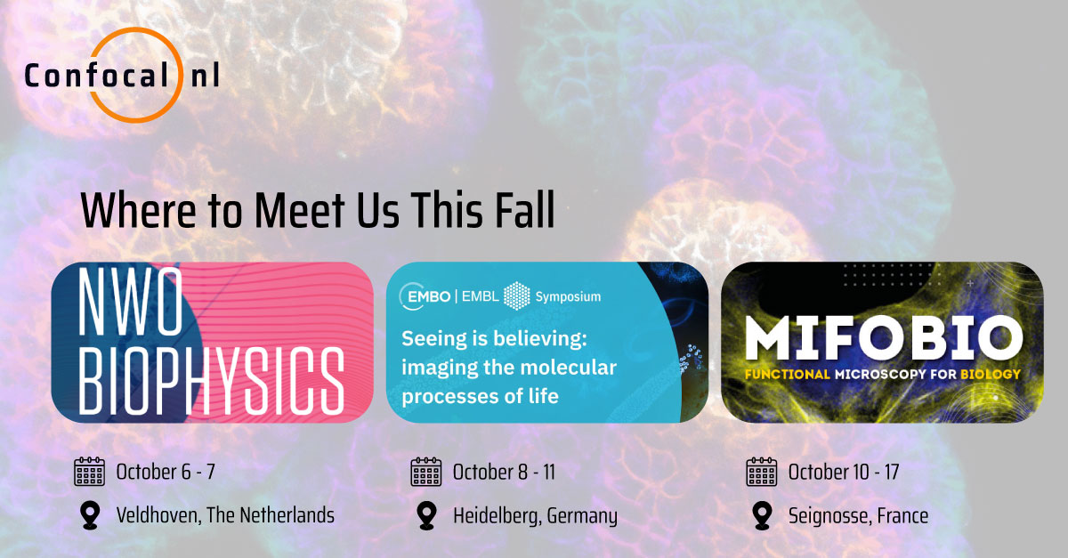 Confocal NL (@confocal_nl) on Twitter photo We are in the middle of summer, and we are preparing for an exciting autumn season full of incredible conferences!
This fall, weâre hitting the road to connect with the microscopy community â hereâs where to find us:
đđđ đđąđšđ©đĄđČđŹđąđđŹ â Veldhoven, Netherlands | We are in the middle of summer, and we are preparing for an exciting autumn season full of incredible conferences!
This fall, weâre hitting the road to connect with the microscopy community â hereâs where to find us:
đđđ đđąđšđ©đĄđČđŹđąđđŹ â Veldhoven, Netherlands |