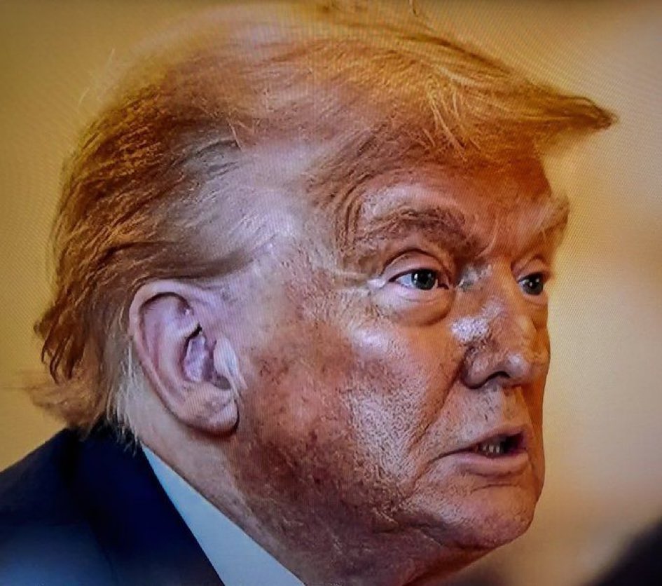 Fernand46357857's tweet image. HE’S ALWAYS BEEN A LYING TWO FACE: NOW HE’S ALSO A TWO COLORED FACE