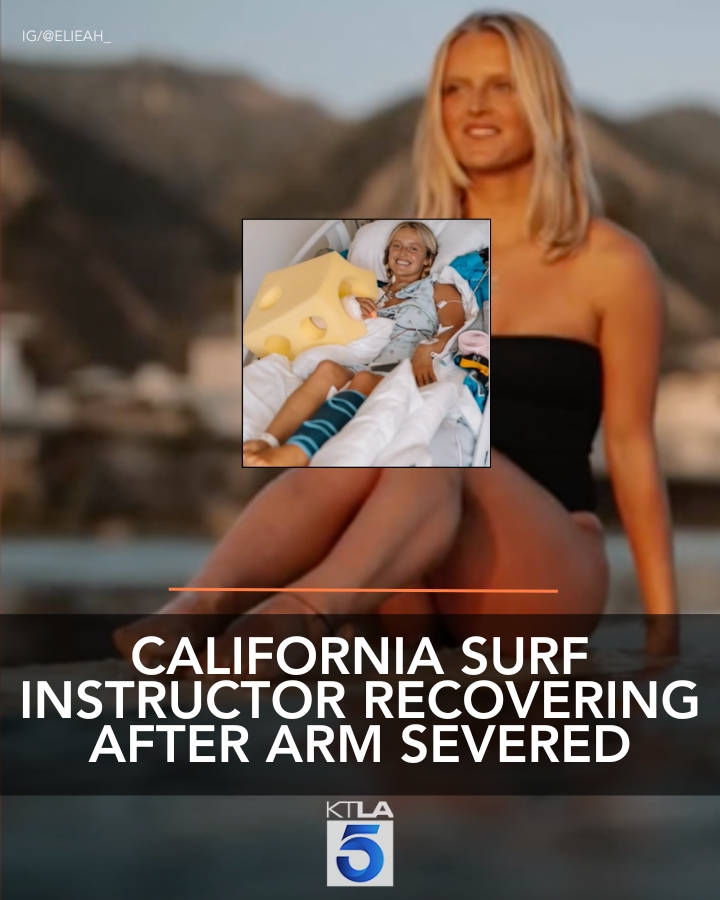 KTLA's tweet image. The 24-year-old underwent a grueling 10-hour surgery to have her arm reattached terrifying accident and has at least two additional surgeries scheduled in the coming weeks. Full Story: ktla.com/news/californi…