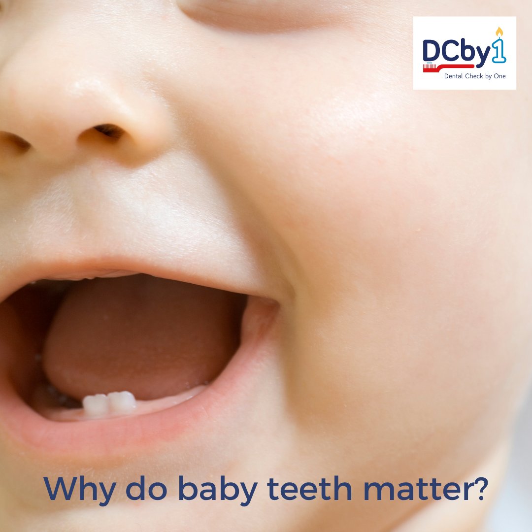 bspduk's tweet image. Why do baby teeth matter?
Baby teeth are matter because they hold the space for permanent teeth. Our guide explains how to keep teeth healthy. The 1st dental visit is an opportunity to get advice on caring for your baby’s teeth. Find out more here: ow.ly/v2AH50WlKNF #DCby1