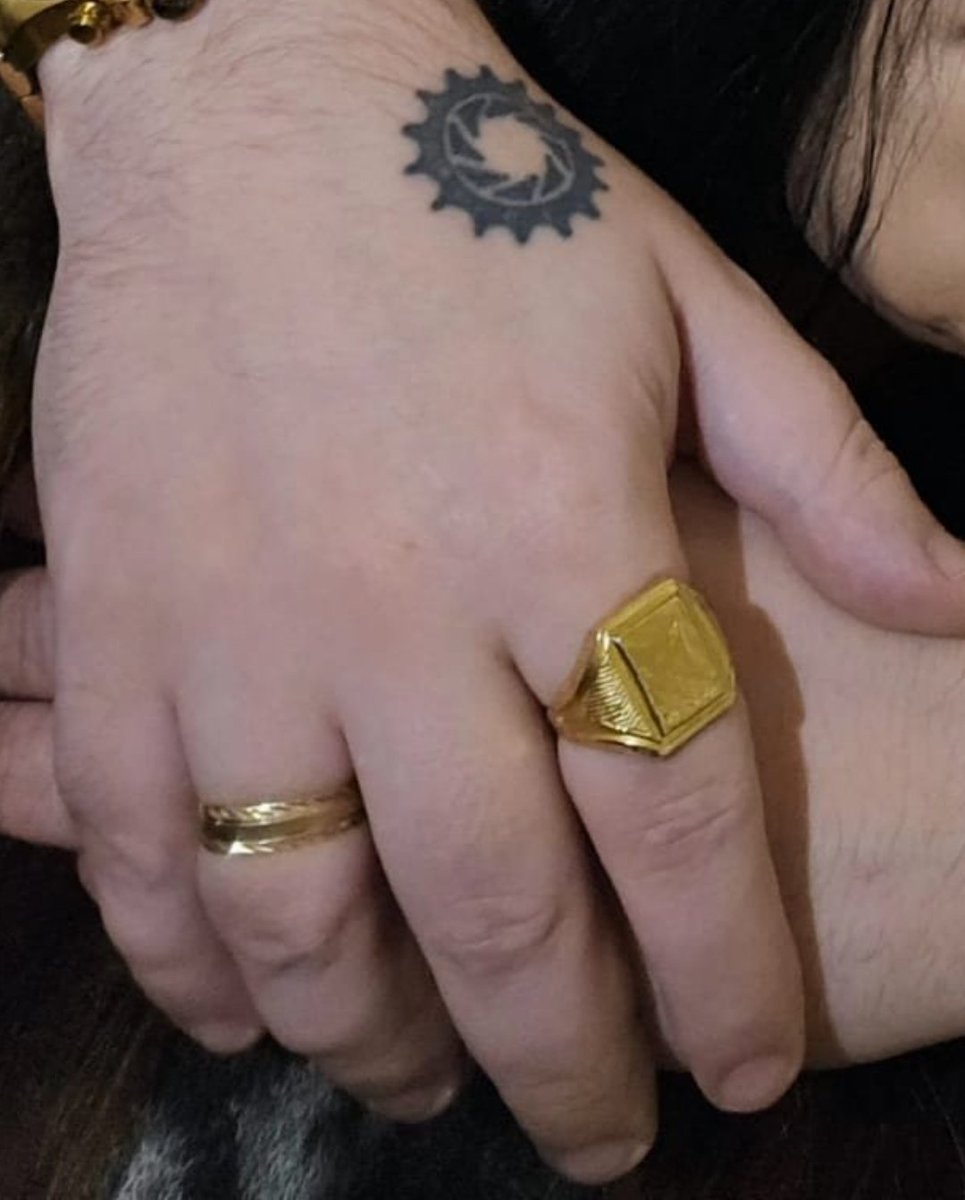 BalldoMania's tweet image. Hey @grok can you look at this picture of @CogCity's hands and tell us what is causing his fingers to swell so much? Please tag him with your best medical opinion